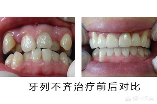 绍兴最新24小时牙医在线咨询方法分析(最方便真实的绍兴有没有24小时牙医方法)